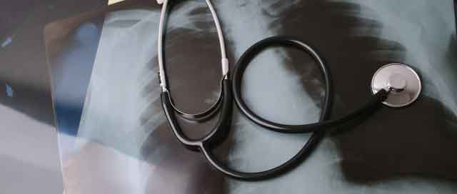 骨折とリハビリ